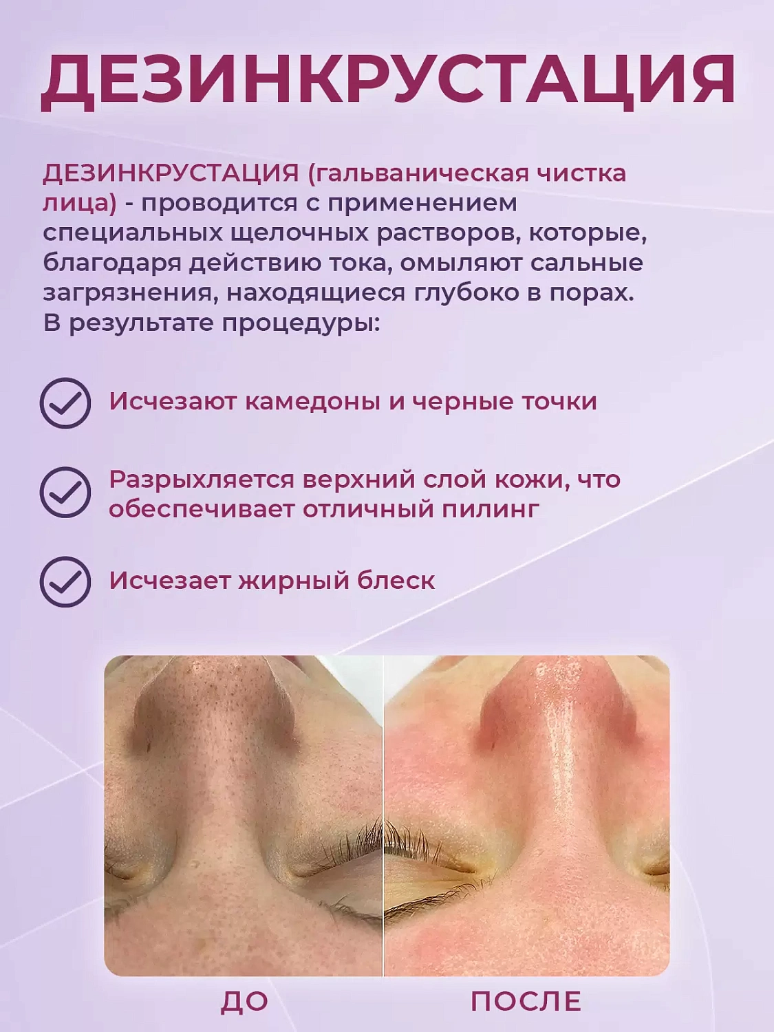 Невотон - профессиональный уход за проблемной кожей